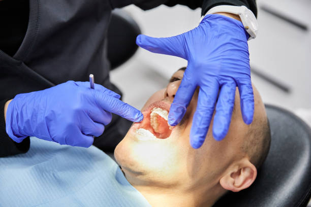 Best Emergency Dentist for Lost Fillings or Crowns in Level Green, PA